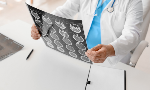 Neurologist looking at images of brain scans